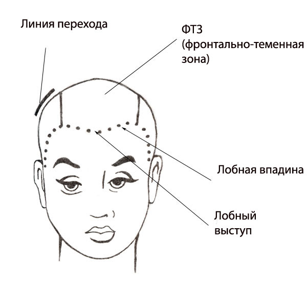 Деление волос на зоны - теменная область
